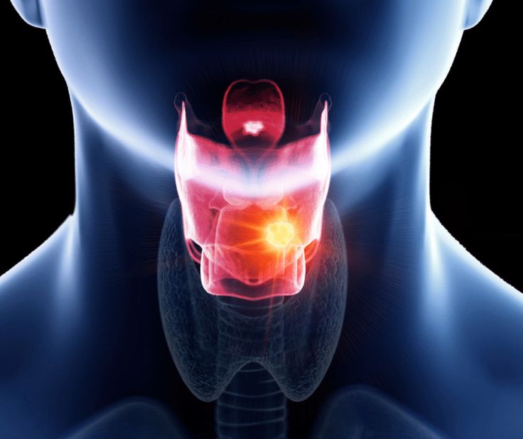 Head and neck cancer awareness and early detection illustration